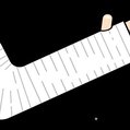 arm cast